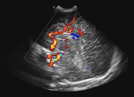 Neonatologia